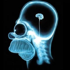 d9c1390937cc374abaf4_brain-on-teenagers.jpg
