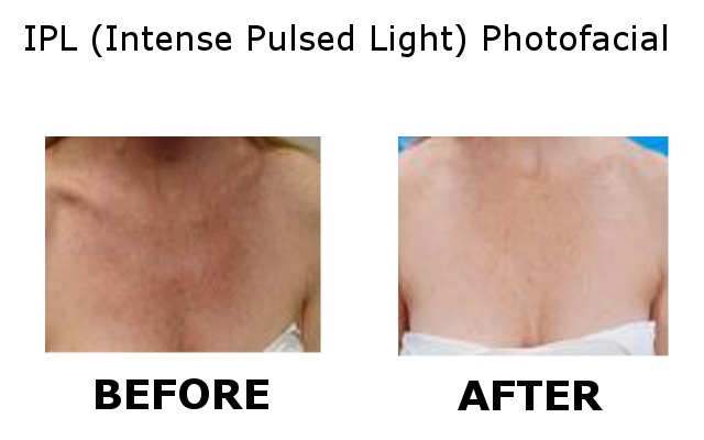 Skin Laser Surgery Specialists Of Ny And Nj Dermatology Office