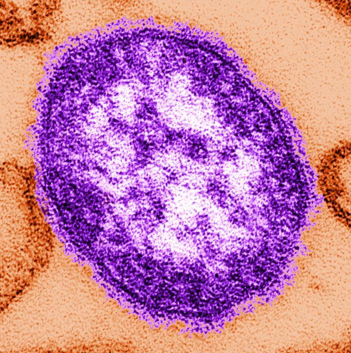 ad127202565936441d8c_measles.jpg