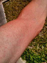 9b02ad84d22db3259763_zika.jpg