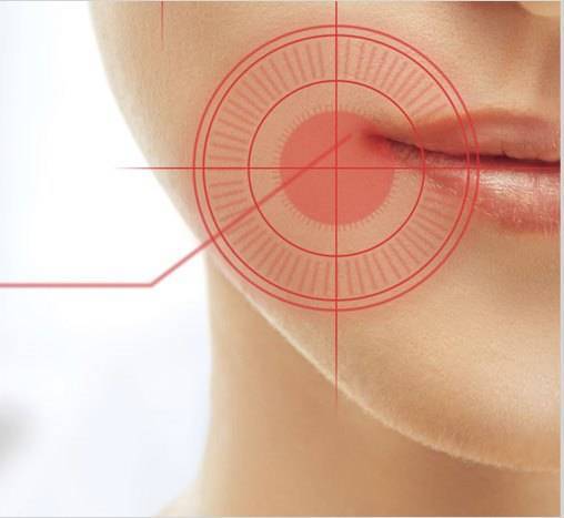 4a989a3b0395801499e0_Oral_Cancer.jpg