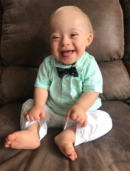 55c3a86ec983070bf7e2_gerber_2018_baby_today_180205_03_5cc2587f5ac3c2fbe963b5ba20766d7c.today-inline-large.jpg